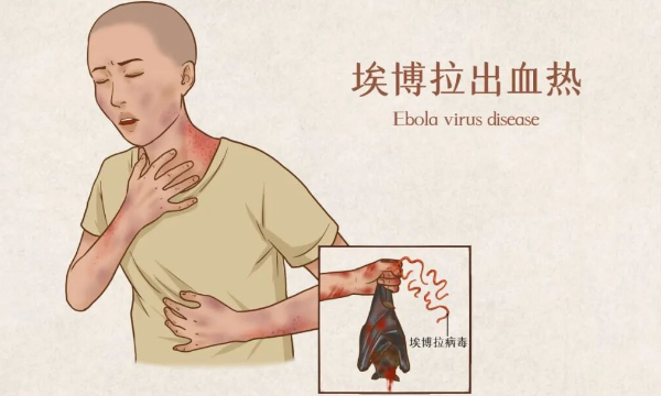 埃博拉病毒持续传播，市民们近期需做好这些防范