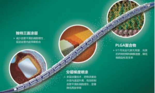 血管也能做“无创体检”？重庆大学相关研发成果项目产品累计销售额达到90亿元！